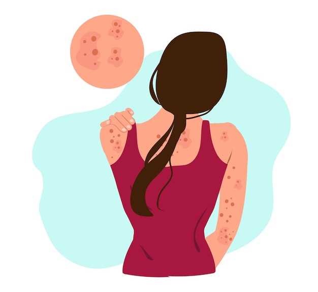 1. Allergic Reactions: