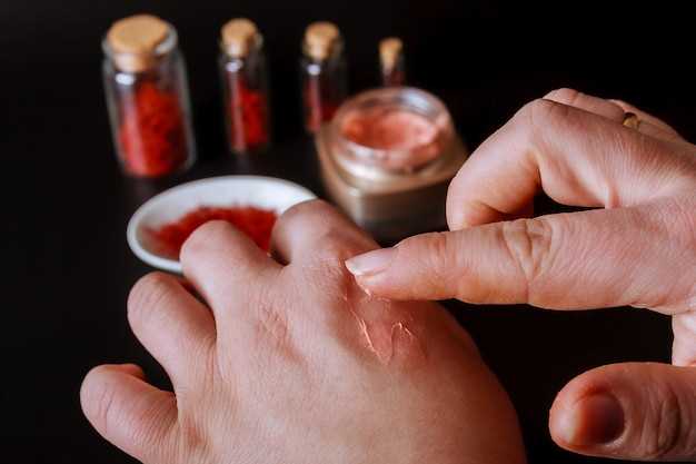 Does losartan cause internal bleeding