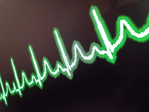 How to monitor your heart rate