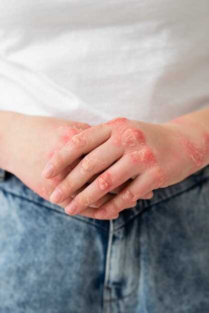 Causes of the Rash